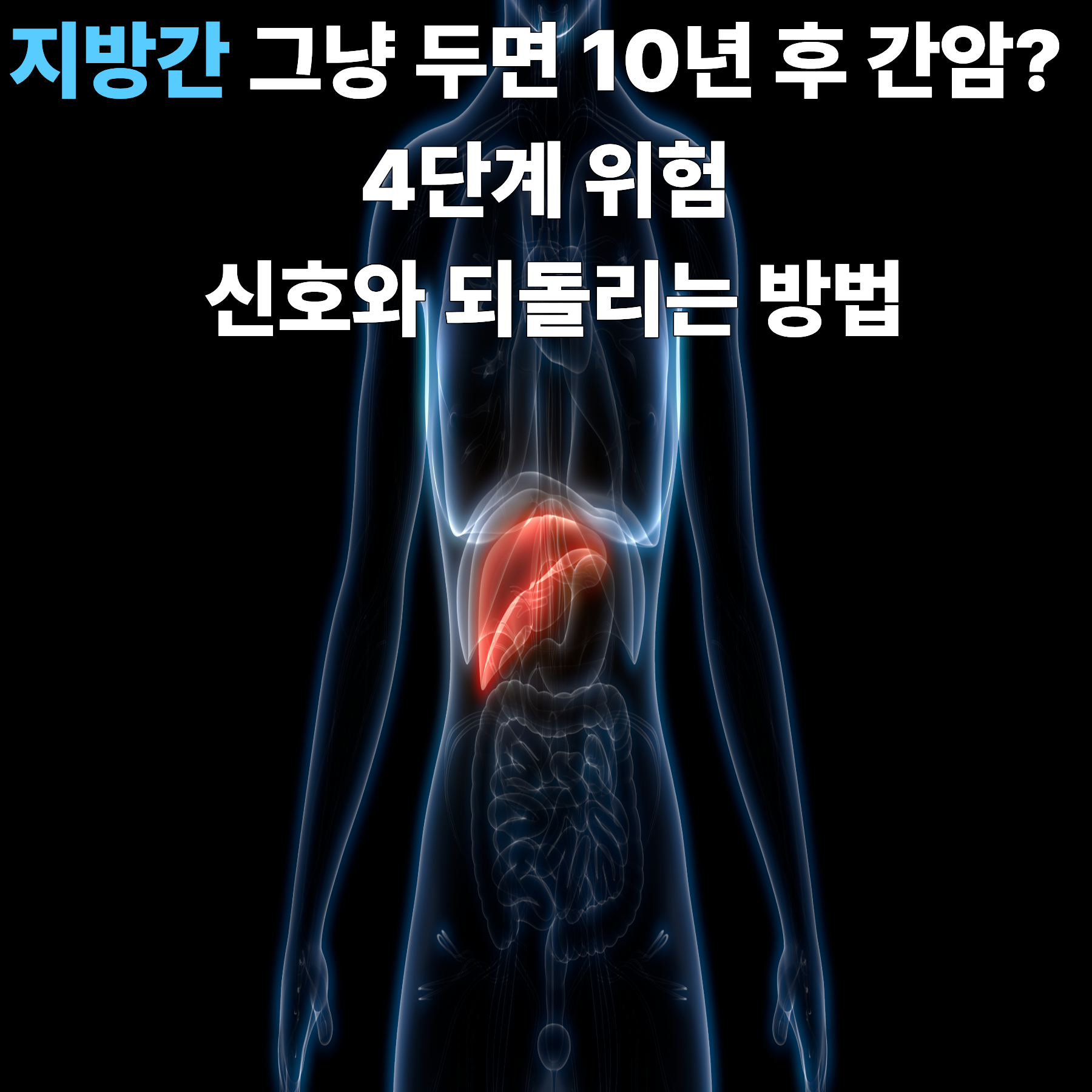 지방간 그냥 두면 10년 후 간암? 4단계 위험 신호와 되돌리는 방법
